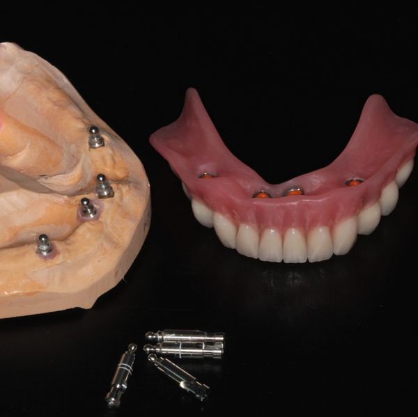 Mini implantáty