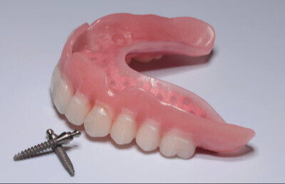 0_Gulickovy_system_mini_implantaty_2