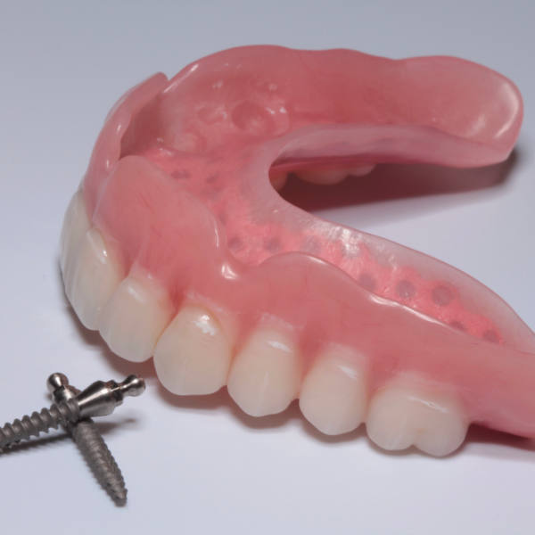 Mini implantáty