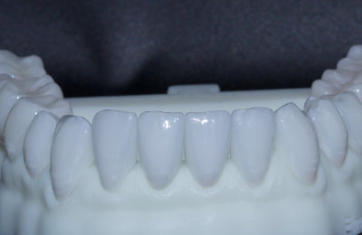 fazety_03_HappyDent_Lab